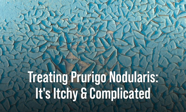 prurigo nodularis treatment